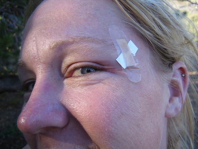Kim's war wound