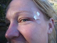 Kim's war wound